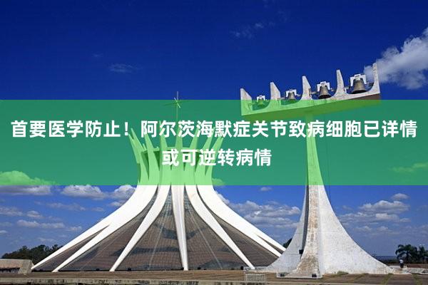 首要医学防止！阿尔茨海默症关节致病细胞已详情 或可逆转病情